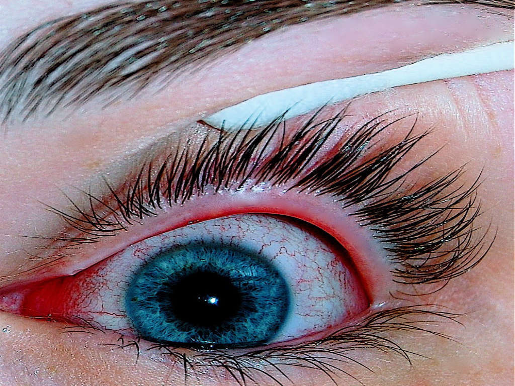 An_eye @indiaataglance.com